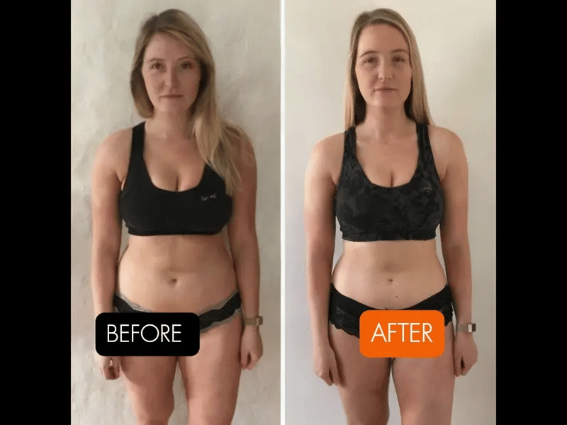 ImpulseX™ Core Stimulator